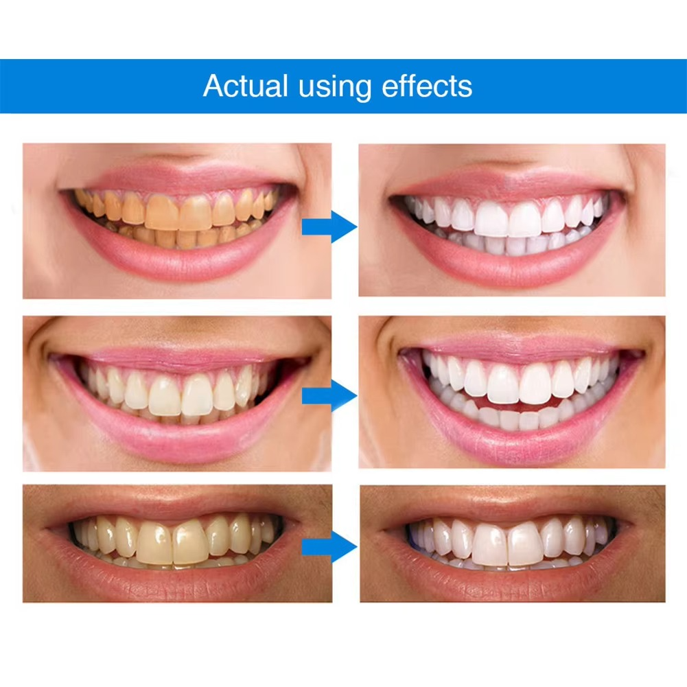 Teeth Whitening Essence Pen