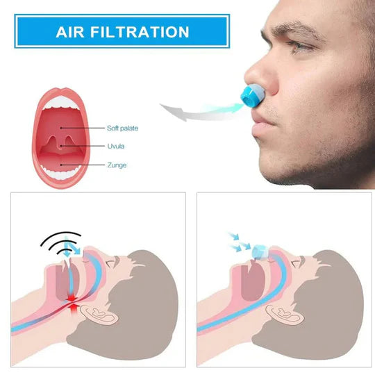 Airing Micro CPAP Device for Snoring Relief