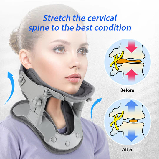 Neck Stretcher Traction Device for Posture Correction and Spinal Relief