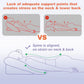 Face Down Pillow for BBL or Eye Surgery Recovery