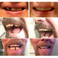 Temporary False Teeth Cosmetic Dental Veneers