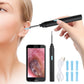 Ear Camera Scope with 20X Magnification and Wireless App Connection