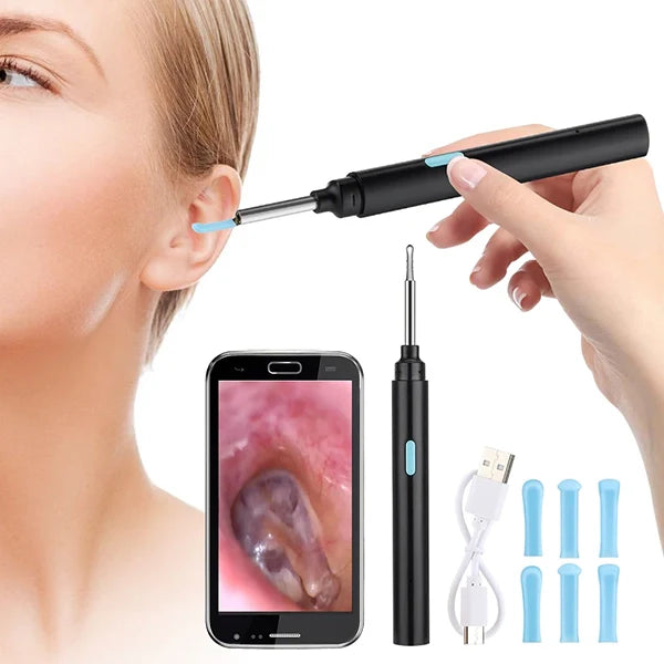 Ear Camera Scope with 20X Magnification and Wireless App Connection