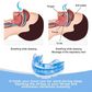 Adjustable Mandibular Advancement Device for Snoring Reduction