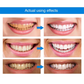 Teeth Whitening Essence Pen