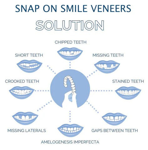 Removable Upper and Lower Cosmetic Smile Cover System