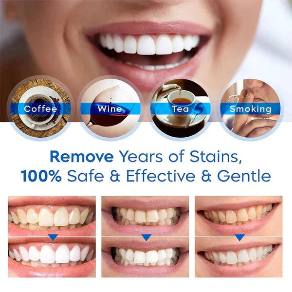 Portable Teeth Whitening Essence Pen for On-the-Go Brightening
