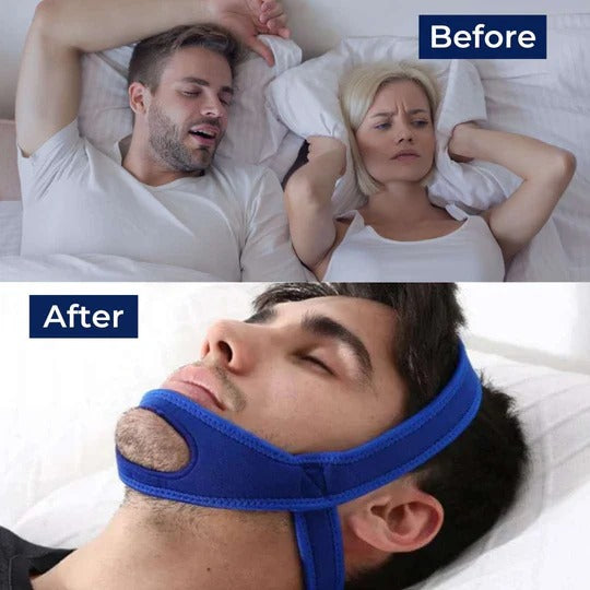 Full Head Chin Strap for Jaw Support During Sleep